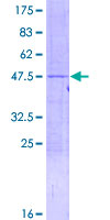 ab159384 on a 12.5% SDS-PAGE stained with Coomassie Blue.