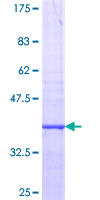 ab159385 on a 12.5% SDS-PAGE stained with Coomassie Blue.