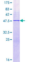 ab159386 on a 12.5% SDS-PAGE stained with Coomassie Blue.