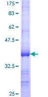 ab159387 on a 12.5% SDS-PAGE stained with Coomassie Blue.