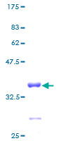 ab160447 on a 12.5% SDS-PAGE stained with Coomassie Blue.
