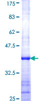 ab160448 on a 12.5% SDS-PAGE stained with Coomassie Blue.