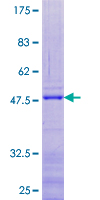 ab159390 on a 12.5% SDS-PAGE stained with Coomassie Blue.