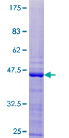 ab159393 on a 12.5% SDS-PAGE stained with Coomassie Blue.
