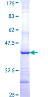 ab159394 on a 12.5% SDS-PAGE stained with Coomassie Blue.