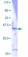 ab161820 on a 12.5% SDS-PAGE stained with Coomassie Blue.