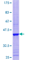 ab161296 on a 12.5% SDS-PAGE stained with Coomassie Blue.