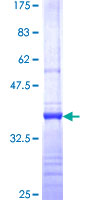 ab161297 on a 12.5% SDS-PAGE stained with Coomassie Blue.