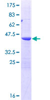 ab160901 on a 12.5% SDS-PAGE stained with Coomassie Blue.