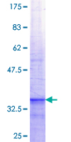 ab160902 on a 12.5% SDS-PAGE stained with Coomassie Blue.