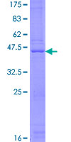 ab164155 on a 12.5% SDS-PAGE stained with Coomassie Blue.