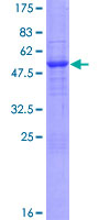 ab161157 on a 12.5% SDS-PAGE stained with Coomassie Blue.