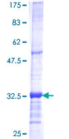 ab161158 on a 12.5% SDS-PAGE stained with Coomassie Blue.