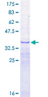 ab159423 on a 12.5% SDS-PAGE stained with Coomassie Blue.