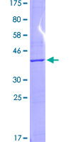 ab159424 on a 12.5% SDS-PAGE stained with Coomassie Blue.