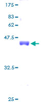 ab159453 on a 12.5% SDS-PAGE stained with Coomassie Blue.