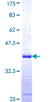 ab159454 on a 12.5% SDS-PAGE stained with Coomassie Blue.