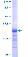 ab159456 on a 12.5% SDS-PAGE stained with Coomassie Blue.