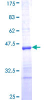ab159457 on a 12.5% SDS-PAGE stained with Coomassie Blue.