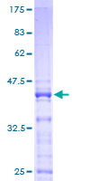 ab159458 on a 12.5% SDS-PAGE stained with Coomassie Blue.