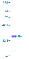 ab159461 on a 12.5% SDS-PAGE stained with Coomassie Blue.
