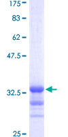 ab159462 on a 12.5% SDS-PAGE stained with Coomassie Blue.