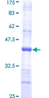 ab159425 on a 12.5% SDS-PAGE stained with Coomassie Blue.