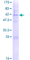 ab159426 on a 12.5% SDS-PAGE stained with Coomassie Blue.