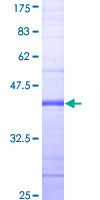 ab162038 on a 12.5% SDS-PAGE stained with Coomassie Blue.