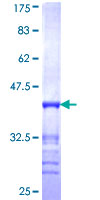 ab164426 on a 12.5% SDS-PAGE stained with Coomassie Blue.