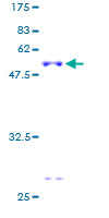 ab159435 on a 12.5% SDS-PAGE stained with Coomassie Blue.