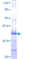 ab159436 on a 12.5% SDS-PAGE stained with Coomassie Blue.