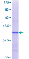 ab159437 on a 12.5% SDS-PAGE stained with Coomassie Blue.