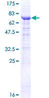 ab163695 on a 12.5% SDS-PAGE stained with Coomassie Blue.