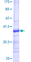 ab163696 on a 12.5% SDS-PAGE stained with Coomassie Blue.