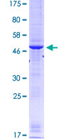 ab152668 on a 12.5% SDS-PAGE stained with Coomassie Blue.