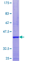 ab162817 on a 12.5% SDS-PAGE stained with Coomassie Blue.