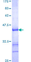 ab162818 on a 12.5% SDS-PAGE stained with Coomassie Blue.