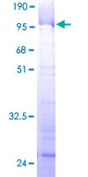 ab160102 on a 12.5% SDS-PAGE stained with Coomassie Blue.