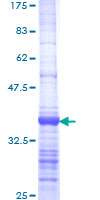 ab161632 on a 12.5% SDS-PAGE stained with Coomassie Blue.