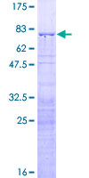 ab161572 on a 12.5% SDS-PAGE stained with Coomassie Blue.