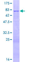ab163060 on a 12.5% SDS-PAGE stained with Coomassie Blue.