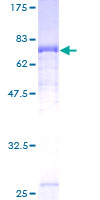 ab163036 on a 12.5% SDS-PAGE stained with Coomassie Blue.