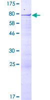 ab162810 on a 12.5% SDS-PAGE stained with Coomassie Blue.