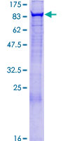ab153182 on a 12.5% SDS-PAGE stained with Coomassie Blue.
