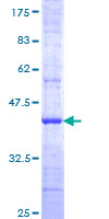 ab153183 on a 12.5% SDS-PAGE stained with Coomassie Blue.