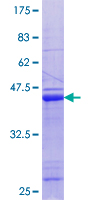 ab162662 on a 12.5% SDS-PAGE stained with Coomassie Blue.