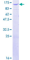 ab159428 on a 12.5% SDS-PAGE stained with Coomassie Blue.