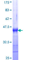 ab159430 on a 12.5% SDS-PAGE stained with Coomassie Blue.