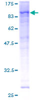 ab159427 on a 12.5% SDS-PAGE stained with Coomassie Blue.